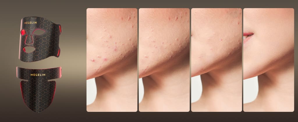 The 486-LED Light Therapy System That Erases Years from Your Face & Neck