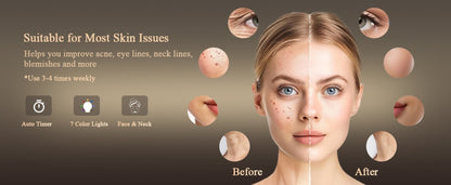 The 486-LED Light Therapy System That Erases Years from Your Face & Neck